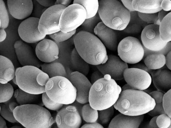 改良酵母抑制植物真菌生长 外用可减少农业对杀菌剂的依赖