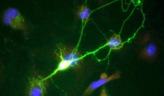遗传程序保护神经元免于退化